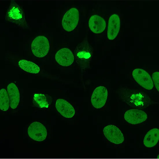 antinuclear antibodies (ana) enzyme-linked immunosorbent assay (elisa) test